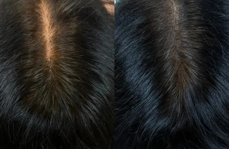 Female Scalp Micropigmentation Cost 2026: Women's SMP Pricing Guide — Therapeutic Cuts Women's SMP guide card image