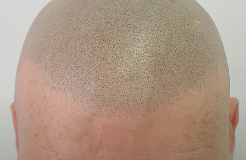 Hair Tattoo Cost NYC: What SMP Really Costs in 2026 — Therapeutic Cuts SMP Cost Guide guide card image