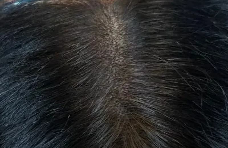 SMP for Women Complete Guide Queens NYC | Female Hair Loss Solution — Therapeutic Cuts SMP Women guide card image