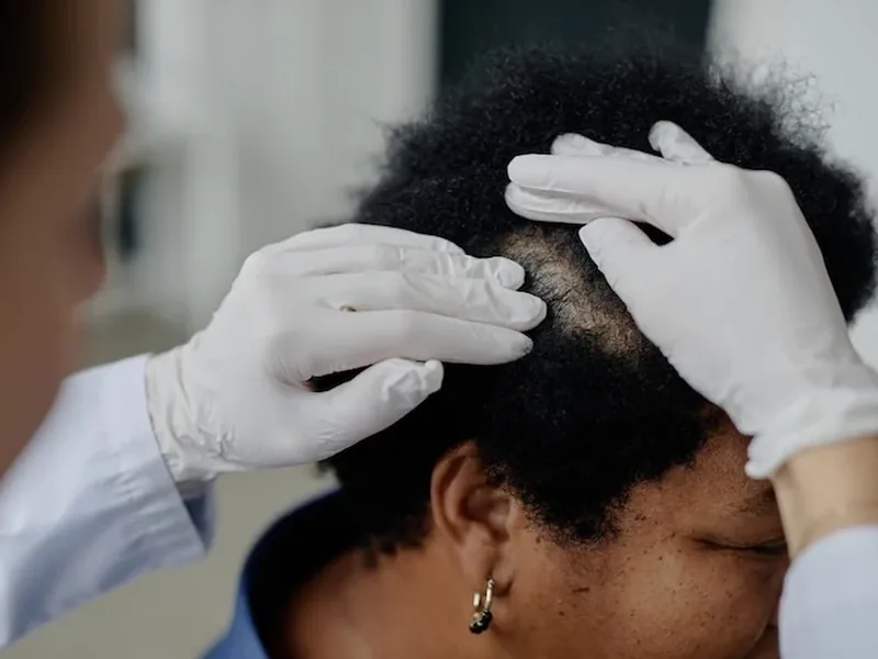Scalp exam before deciding whether SMP is a good fit