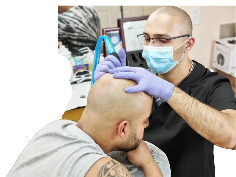 Scalp micropigmentation procedure in Queens NYC
