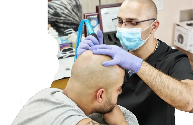 Scalp micropigmentation practitioner performing an SMP procedure session