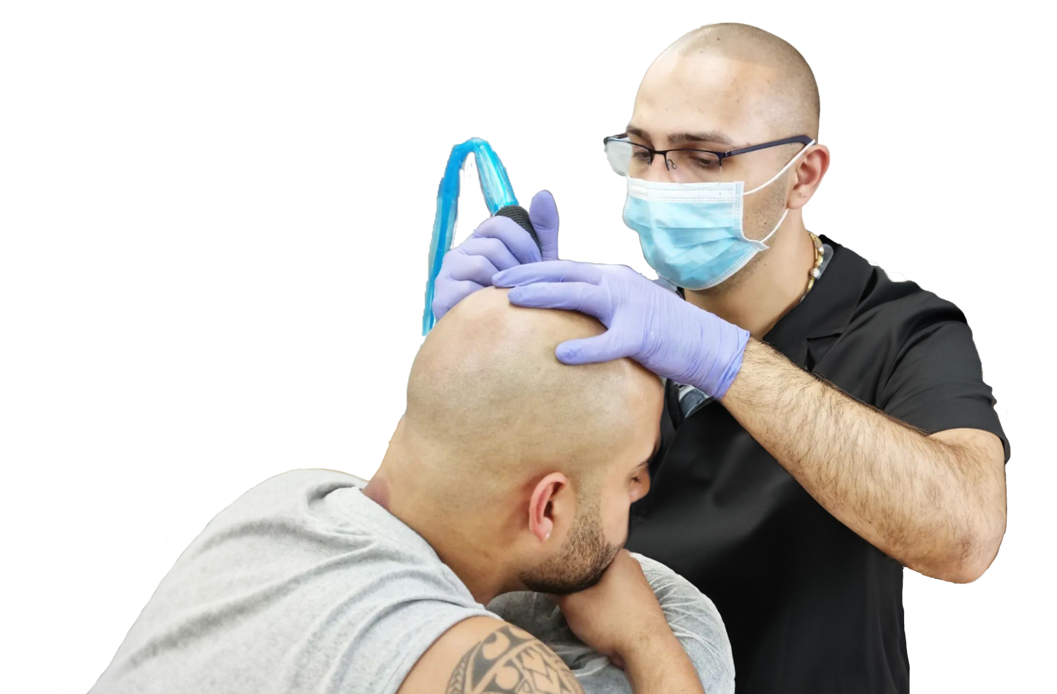 Scalp Micropigmentation